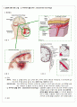 성인 실습, SICU(SAH, 지주막하 출혈) 3페이지