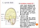 뇌사, brain death, 뇌사의정의, 뇌사의종류, 뇌사의판정, 뇌사자 장기이식, 뇌사 윤리적문제, 죽음, 우리나라 뇌사사례, 국외 뇌사사례 2페이지