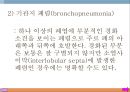 폐렴, 폐렴정의, 폐렴분류, 폐렴병태생리, 폐렴빈도, 폐렴위험요인, 폐렴증상, 폐렴치료, 폐렴합병증, 폐렴예후, 폐렴 케이스스터디, ICU Case Study, Pneumonia, 6페이지