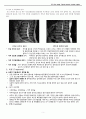 척추관 협착증 Spinal stenosis -A+받은 자료입니다. 5페이지