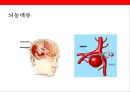 뇌 • 심혈관계질환의 이해 및 예방 7페이지