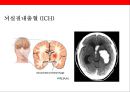 뇌 • 심혈관계질환의 이해 및 예방 10페이지