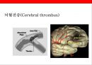 뇌 • 심혈관계질환의 이해 및 예방 11페이지