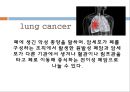 [간호학과] 폐암 사례연구 (lung cancer case study) 2페이지