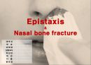 응급간호학 코피 epistaxis 비골 골절 nasal bone fracture 발표 자료 1페이지