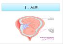 조기양막파열 케이스 PPT (연구의 필요성부터 ~ 문헌고찰,간호과정, 간호사정, 간호진단, 느낀점 ) A+++++ 3페이지