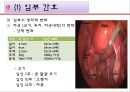 정상임산부,고위험임산부,산모간호 PPT(레포트) A++++++ 4페이지