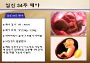 수정과 태아 발달(배란,수정,착상,임신4주~임신40주까지 태아 정리)A++++++ 30페이지