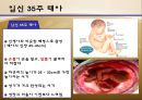 수정과 태아 발달(배란,수정,착상,임신4주~임신40주까지 태아 정리)A++++++ 31페이지