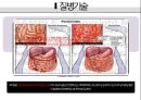 복막염, penperitonitis, 케이스스터디, case study, 간호과정, SOAPIE, 간호진단, 간호사정, 간호계획, 간호중재, 간호평가 4페이지