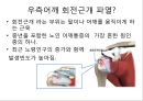 우측어깨회전근개파열, 간호과정, case study, 케이스스터디, 간호진단, 간호사정, 간호계획, 간호중재, 간호평가, 근골격계 간호진단 4페이지