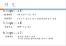 hepatitis, 간염, 간염원인, 간염병태생리, 간염증상, 간염징후, 간염간호, 간염진단, 간염치료, 간염예방, 독성간염, 알코올성간염, 전격성간염, 간염간호과정 8페이지