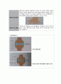   골관절염 A+ 5페이지