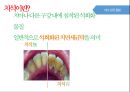 청소년기 구강관리 보건교육 ppt 파일 (구강보건교육, 치아관리, 치과) 11페이지