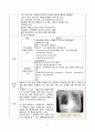 중환자실 폐려, 폐부종 간호과정 2페이지
