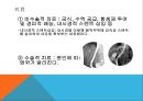 복막염, penperitonitis, 케이스스터디, case study, 간호과정, SOAPIE, 간호진단, 간호사정, 간호계획, 간호중재, 간호평가 7페이지