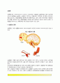 [뇌졸중] 뇌졸중의 종류와 증상, 뇌졸중 위험인자 및 예방, 뇌졸중의 진단과 치료방법(뇌졸중 약물요법, 수술요법, 운동요법, 식이요법) 2페이지