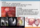 부인과 간호과정 자료입니다 -- 난소낭종 case study ( A+ 받았습니다.) 5페이지