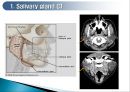 두경부 (Head & Neck) CT 에 관하여 4페이지