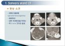 두경부 (Head & Neck) CT 에 관하여 9페이지