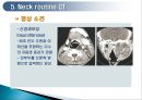 두경부 (Head & Neck) CT 에 관하여 27페이지