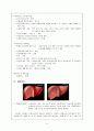 csse- 내과 LC - Liver cirrhosis with ascites 간경화 A+ #케이스 스터디 # CASE STUDY #복수천자 4페이지