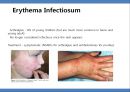 Common skin rashes in children, 소아 피부 발진 16페이지