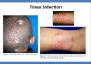 Common skin rashes in children, 소아 피부 발진 20페이지