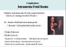 다태 임신 (Multifetal gestation) 의대 간호대 발표 PPT 11페이지