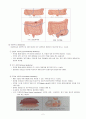 결장 직장암의 치료와 간호(1. 치료 2. 간호 3. 간호진단) 3페이지