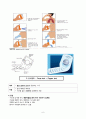 호흡기 치료 및 간호에 사용하는 기구(1. 분무기 2. 최대호기유속기(PEFM) 3. 정량식 흡입기 (MDI) 4. 조동점액 청결기구 5. 산소텐트) 6페이지