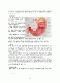 간호,case study,성인(병동),위의 악성 신생물 (위암) (Malignant neoplasm of body of stomach) 3페이지