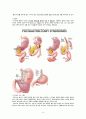 간호,case study,성인(병동),위의 악성 신생물 (위암) (Malignant neoplasm of body of stomach) 6페이지
