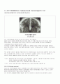 지주막하출혈 케이스(SAH, Subarachnoid Hemorrhage) 4페이지