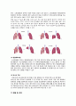 폐암 케이스(Lung cancer) 4페이지