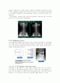 척추관협착증 케이스 스터디 A+ 7페이지