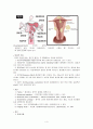  산부인과 케이스 스터디 : Leiomyoma of uterus(자궁근종) 4페이지