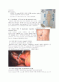 수술실 CASE STUDY : Laparoscopic cholecystectomy (복강경 담낭절제술) 3페이지