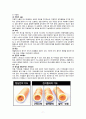 천식 asthma 성인간호학 케이스 간호과정 간호진단 9페이지