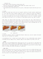 HBV – HCC 케이스 B형간염 바이러스 - 간세포 암종 Hepatitis B virus Hepatocellular carcinoma 간호과정 7페이지