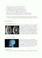 A+ SDH 경막하 출혈 케이스 스터디 5페이지