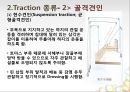 견인치료(traction) PPT 14페이지