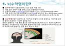 뇌수막염(Meningitis) PPT 2페이지