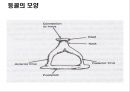 청각기관의 구조 및 장애발생 원인, 분류 11페이지