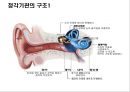청각기관의 구조 및 장애발생 원인, 분류 21페이지
