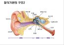 청각기관의 구조 및 장애발생 원인, 분류 22페이지