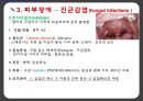 아동간호학 피부감각계 ppt및 관련논문 요약,case study 7페이지