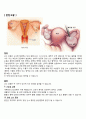 [모성간호학 실습] A+받은 Ovarian cyst(난소낭종) 케이스 2페이지