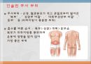 당뇨(DM) PPT 23페이지