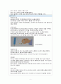 중환자실(ICU) ICH case, A+성적 받은 특급 칭찬 자료입니다!!! 만점보장!!!!!! 5페이지